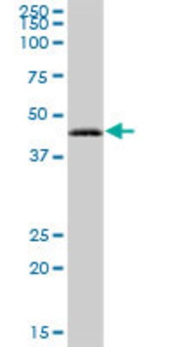 RAB3IL1, Mouse anti-Human, Polyclonal Antibody, Abnova 50&mu;g; Unconjugated:Antibodies,