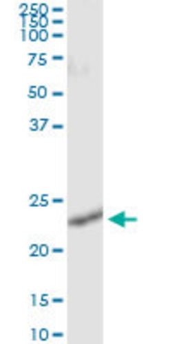 RALB, Mouse anti-Human, Clone: 4D1, Abnova 100 &mu;g | Buy Online | Abnova | Fisher Scientific