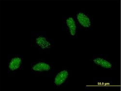 RBBP6, Mouse anti-Human, Polyclonal Antibody, Abnova 50&mu;g; Unconjugated:Antibodies,