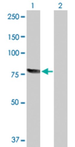 RECQL, Rabbit anti-Human, Polyclonal Antibody, Abnova 100&mu;g; Unconjugated:Antibodies,