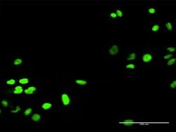 RECQL, Rabbit anti-Human, Polyclonal Antibody, Abnova 100&mu;g; Unconjugated:Antibodies,