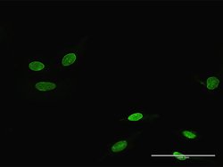 RORA, Rabbit anti-Human, Polyclonal Antibody, Abnova 100&mu;g; Unconjugated:Antibodies,