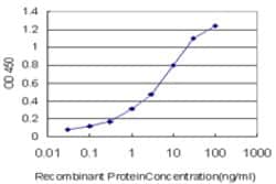 RORB, Mouse anti-Human, Clone: 1D8, Abnova 100&mu;g; Unconjugated:Antibodies,