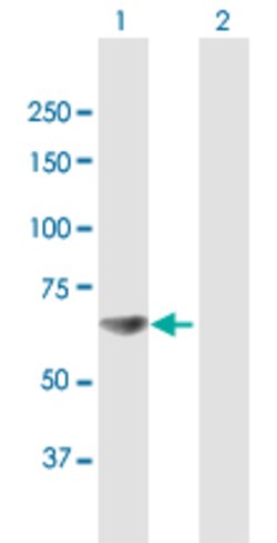 RPA1, Mouse anti-Human, Polyclonal Antibody, Abnova 50&mu;g; Unconjugated:Antibodies,