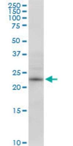 RPE, Mouse anti-Human, Polyclonal Antibody, Abnova 50&mu;g; Unconjugated:Antibodies,