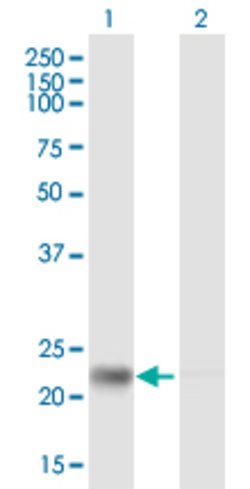 RPE, Mouse anti-Human, Polyclonal Antibody, Abnova 50&mu;g; Unconjugated:Antibodies,