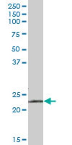 RPE, Mouse anti-Human, Polyclonal Antibody, Abnova 50&mu;g; Unconjugated:Antibodies,