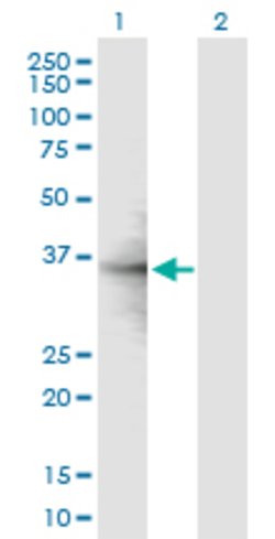 RPL6, Mouse anti-Human, Polyclonal Antibody, Abnova 50&mu;g; Unconjugated:Antibodies,