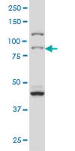 RPS6KA2, Mouse anti-Human, Clone: 1F6, Abnova 100&mu;g; Unconjugated:Antibodies,