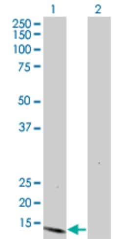 S100A7, Mouse anti-Human, Clone: 2F5, Abnova 100&mu;g; Unconjugated:Antibodies,