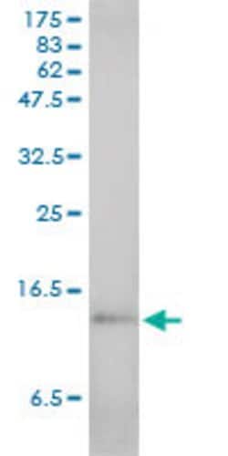 SAA1, Mouse anti-Human, Clone: 3C11-2C1, Abnova 100&mu;g; Unconjugated:Antibodies,