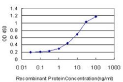SCN3A, Mouse anti-Human, Clone: 3F3, Abnova 100&mu;g; Unconjugated:Antibodies,