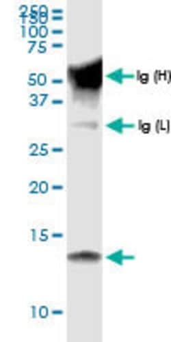 CCL15, Rabbit anti-Human, Polyclonal Antibody, Abnova 100&mu;L; Unconjugated:Antibodies,