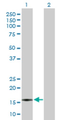 CXCL5, Rabbit anti-Human, Polyclonal Antibody, Abnova 100&mu;g; Unconjugated:Antibodies,
