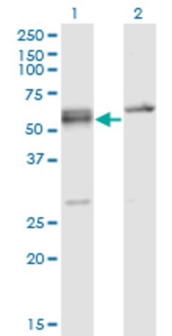 SFRS6, Mouse anti-Human, Clone: 5G6, Abnova 100&mu;g; Unconjugated:Antibodies,
