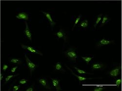 SFRS6, Mouse anti-Human, Clone: 5G6, Abnova 100&mu;g; Unconjugated:Antibodies,