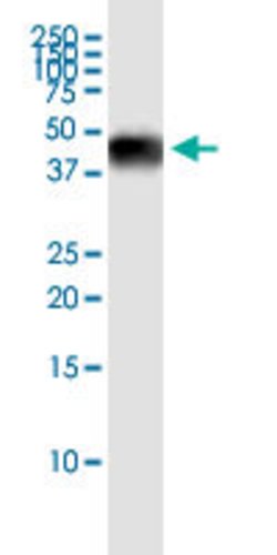 SFTPB, Rabbit anti-Human, Polyclonal Antibody, Abnova 100&mu;L; Unconjugated:Antibodies,