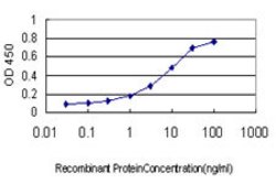 SFTPD, Mouse anti-Human, Clone: 2C10, Abnova 100&mu;g; Unconjugated:Antibodies,
