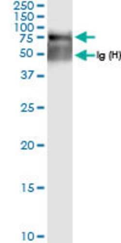 SGSH, Rabbit anti-Human, Polyclonal Antibody, Abnova 100&mu;L; Unconjugated:Antibodies,