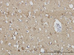 SH3GL2, Mouse anti-Human, Clone: 5A6, Abnova 100&mu;g; Unconjugated:Antibodies,