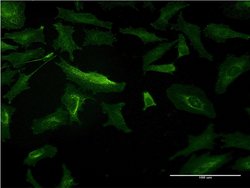 SLC3A1, Mouse anti-Human, Clone: 3G3, Abnova 100&mu;g; Unconjugated:Antibodies,