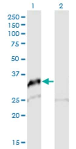 SNAI2, Mouse anti-Human, Polyclonal Antibody, Abnova 50&mu;g; Unconjugated:Antibodies,