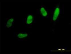 SNAI2, Mouse anti-Human, Polyclonal Antibody, Abnova 50&mu;g; Unconjugated:Antibodies,