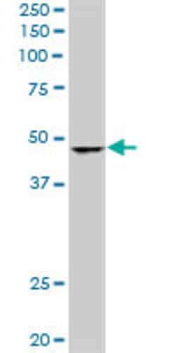SMARCB1, Mouse anti-Human, Clone: 3E10, Abnova 100&mu;g; Unconjugated:Antibodies,