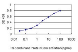 SMARCB1, Mouse anti-Human, Clone: 3E10, Abnova 100&mu;g; Unconjugated:Antibodies,