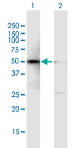 SMARCE1, Mouse anti-Human, Polyclonal Antibody, Abnova 50 &mu;g | Buy Online | Abnova | Fisher Scientific