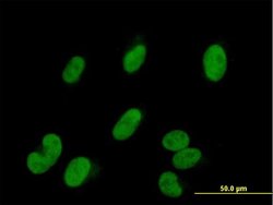 SMARCE1, Mouse anti-Human, Polyclonal Antibody, Abnova 50 &mu;g | Buy Online | Abnova | Fisher Scientific