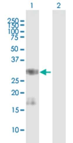 SNAI1, Mouse anti-Human, Polyclonal Antibody, Abnova 50&mu;g; Unconjugated:Antibodies,