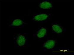 SNAI1, Mouse anti-Human, Polyclonal Antibody, Abnova 50&mu;g; Unconjugated:Antibodies,