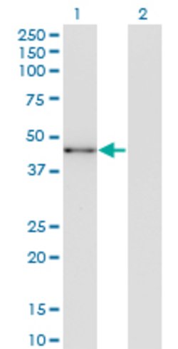 SOX12, Mouse anti-Human, Clone: 4A7, Abnova 100&mu;g; Unconjugated:Antibodies,