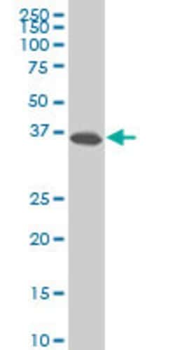SPP1, Mouse anti-Human, Clone: 1D4, Abnova 100&mu;g; Unconjugated:Antibodies,
