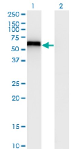SPP1, Mouse anti-Human, Clone: 4C4, Abnova 100&mu;g; Unconjugated:Antibodies,