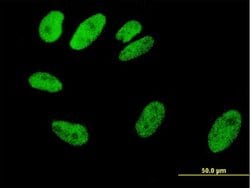 SRF, Mouse anti-Human, Clone: 2G2, Abnova 100&mu;g; Unconjugated:Antibodies,