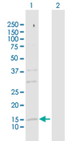 SRP19, Rabbit anti-Human, Polyclonal Antibody, Abnova 100 &mu;g | Buy Online | Abnova | Fisher Scientific