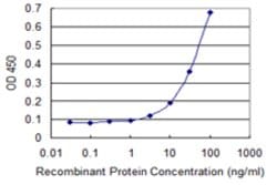 SRP68, Mouse anti-Human, Clone: 3A3, Abnova 100&mu;g; Unconjugated:Anticuerpos