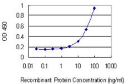TRIM21, Mouse anti-Human, Clone: 2C9, Abnova 100 &mu;g | Buy Online | Abnova | Fisher Scientific