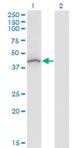 STAT5B, Mouse anti-Human, Clone: 1C2, Abnova 100&mu;g; Unconjugated:Antibodies,