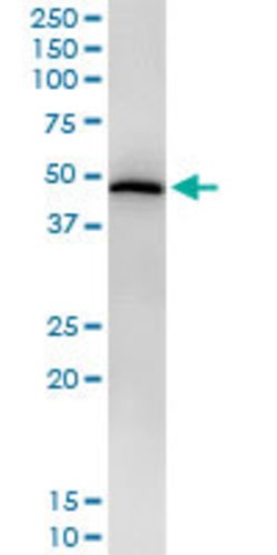 STAT5B, Mouse anti-Human, Clone: 1C2, Abnova 100&mu;g; Unconjugated:Antibodies,