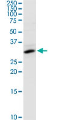SULT1E1, Rabbit anti-Human, Polyclonal Antibody, Abnova 100&mu;g; Unconjugated:Antibodies,