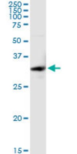 SULT1E1, Rabbit anti-Human, Polyclonal Antibody, Abnova 100&mu;g; Unconjugated:Antibodies,
