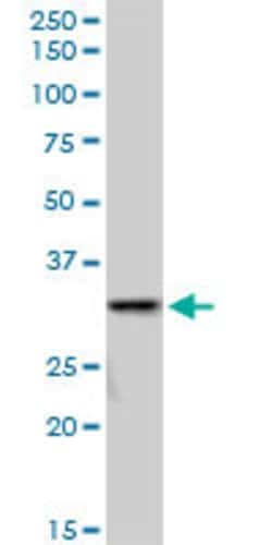 SULT1A3, Mouse anti-Human, Polyclonal Antibody, Abnova 50&mu;g; Unconjugated:Antibodies,