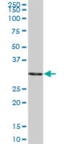 SULT1A3, Mouse anti-Human, Polyclonal Antibody, Abnova 50&mu;g; Unconjugated:Antibodies,