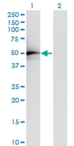 TADA2L, Mouse anti-Human, Clone: 4A8-1A7, Abnova 100&mu;g; Unconjugated:Antibodies,