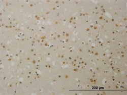 TBL1X, Mouse anti-Human, Clone: 2B6, Abnova 100 &mu;g | Buy Online | Abnova | Fisher Scientific