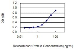 TBX3, Mouse anti-Human, Clone: 3A7, Abnova 100&mu;g; Unconjugated:Antibodies,
