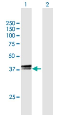 TEF, Mouse anti-Human, Polyclonal Antibody, Abnova 50 &mu;g | Buy Online | Abnova | Fisher Scientific